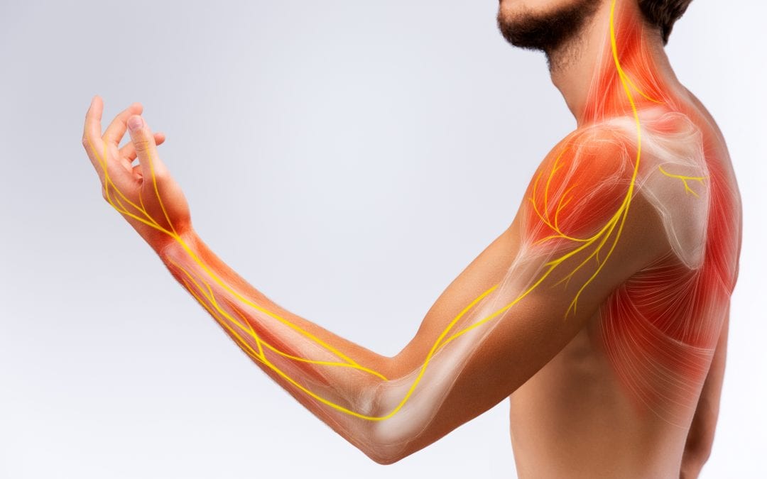 Neuralgia